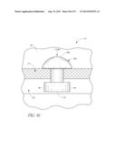 OCULAR IMPLANT SYSTEM diagram and image