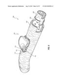 SUBCUTANEOUS VASCULAR ACCESS PORTS HAVING ATTACHMENT FEATURES diagram and image