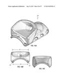 SUBCUTANEOUS VASCULAR ACCESS PORTS HAVING ATTACHMENT FEATURES diagram and image