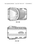 SUBCUTANEOUS VASCULAR ACCESS PORTS HAVING ATTACHMENT FEATURES diagram and image