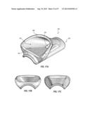 SUBCUTANEOUS VASCULAR ACCESS PORTS HAVING ATTACHMENT FEATURES diagram and image