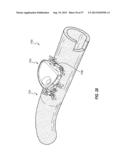 SUBCUTANEOUS VASCULAR ACCESS PORTS HAVING ATTACHMENT FEATURES diagram and image