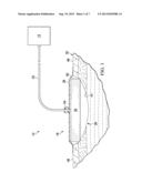 WOUND TREATMENT APPARATUSES AND METHODS FOR CONTROLLED DELIVERY OF FLUIDS     TO A WOUND diagram and image