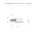 HYDROGEL BASED OCCLUSION SYSTEMS diagram and image