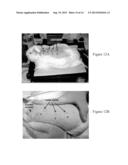 METHOD FOR PICOSECOND AND FEMTOSECOND LASER TISSUE WELDING diagram and image