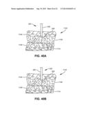 SURGICAL DRILL WITH DRIVE SHAFT AND DRILL BIT THAT, AFTER DISENGAGING THE     DRILL BIT FROM THE DRIVE SHAFT, ALLOWS THE DRILL BIT TO BE DRIVEN IN     REVERSE diagram and image