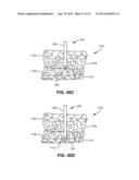 SURGICAL DRILL WITH DRIVE SHAFT AND DRILL BIT THAT, AFTER DISENGAGING THE     DRILL BIT FROM THE DRIVE SHAFT, ALLOWS THE DRILL BIT TO BE DRIVEN IN     REVERSE diagram and image