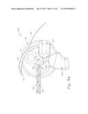 LAPAROSCOPIC SUTURING INSTRUMENT WITH RACK DRIVE diagram and image