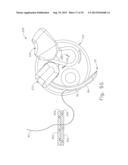 LAPAROSCOPIC SUTURING INSTRUMENT WITH RACK DRIVE diagram and image