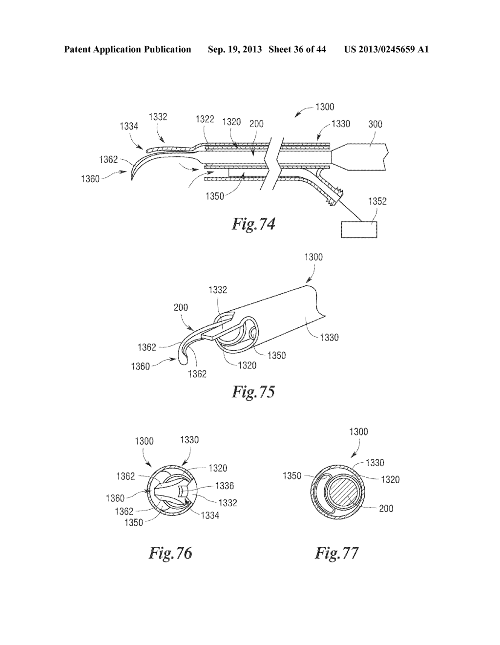 ROTATABLE CUTTING IMPLEMENTS WITH FRICTION REDUCING MATERIAL FOR     ULTRASONIC SURGICAL INSTRUMENTS - diagram, schematic, and image 37