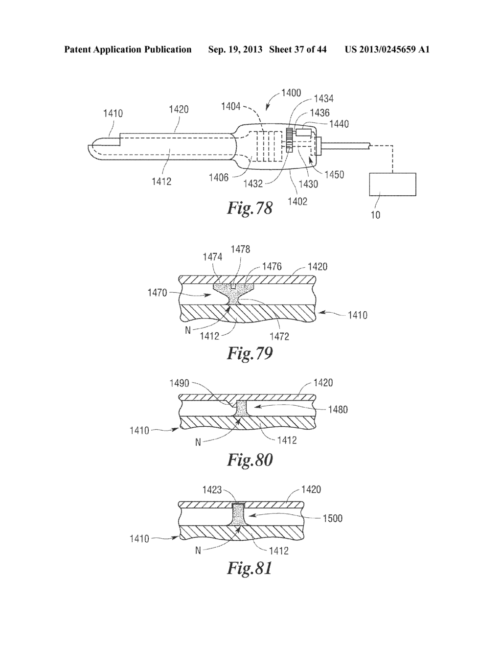 ROTATABLE CUTTING IMPLEMENTS WITH FRICTION REDUCING MATERIAL FOR     ULTRASONIC SURGICAL INSTRUMENTS - diagram, schematic, and image 38