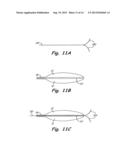 SYSTEM AND METHOD FOR REDUCING PULSATILE PRESSURE diagram and image