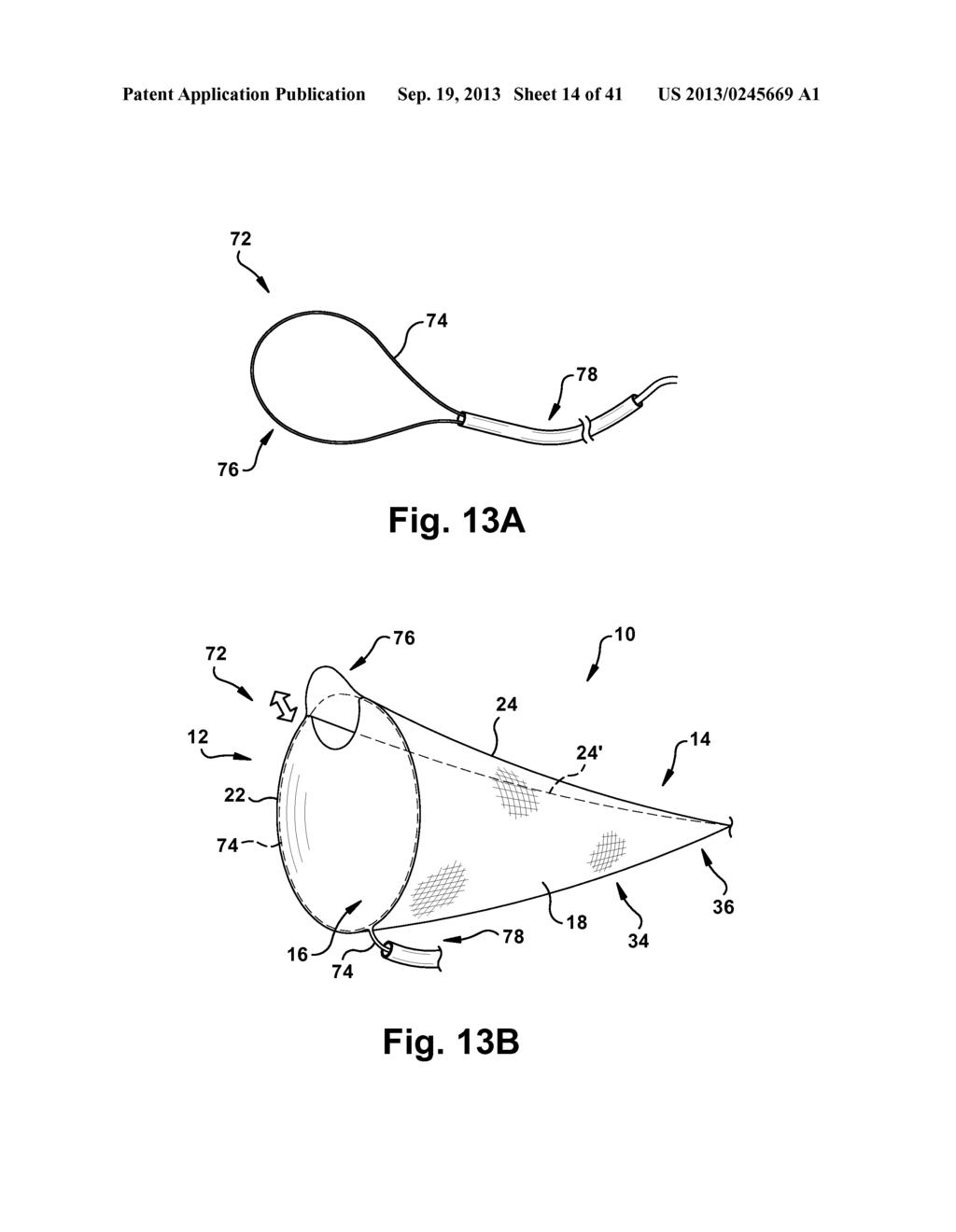 EMBOLIC FILTER DEVICES, SYSTEMS, AND METHODS FOR CAPTURING EMBOLI DURING     MEDICAL PROCEDURES - diagram, schematic, and image 15