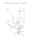 Vein Presentation Enhancement Device diagram and image