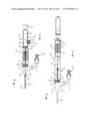 Vein Presentation Enhancement Device diagram and image