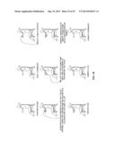 Vein Presentation Enhancement Device diagram and image