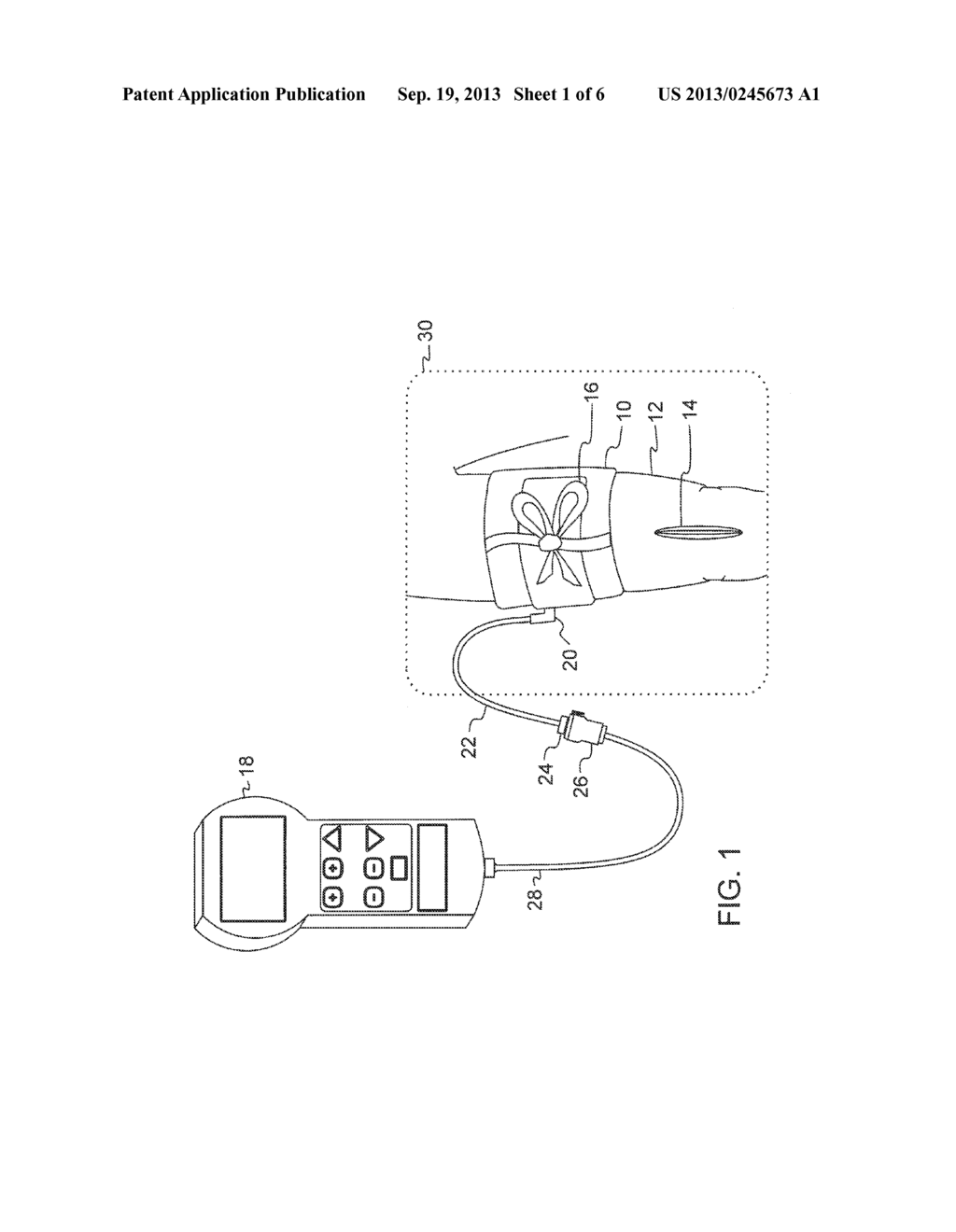 LOW COST TOURNIQUET CUFF WITH INTEGRATED MANUFACTURE INDICIA - diagram, schematic, and image 02