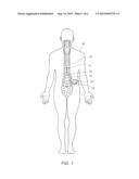 IMPLANTABLE MEDICAL ELECTRICAL LEAD AND CONNECTOR ASSEMBLY diagram and image