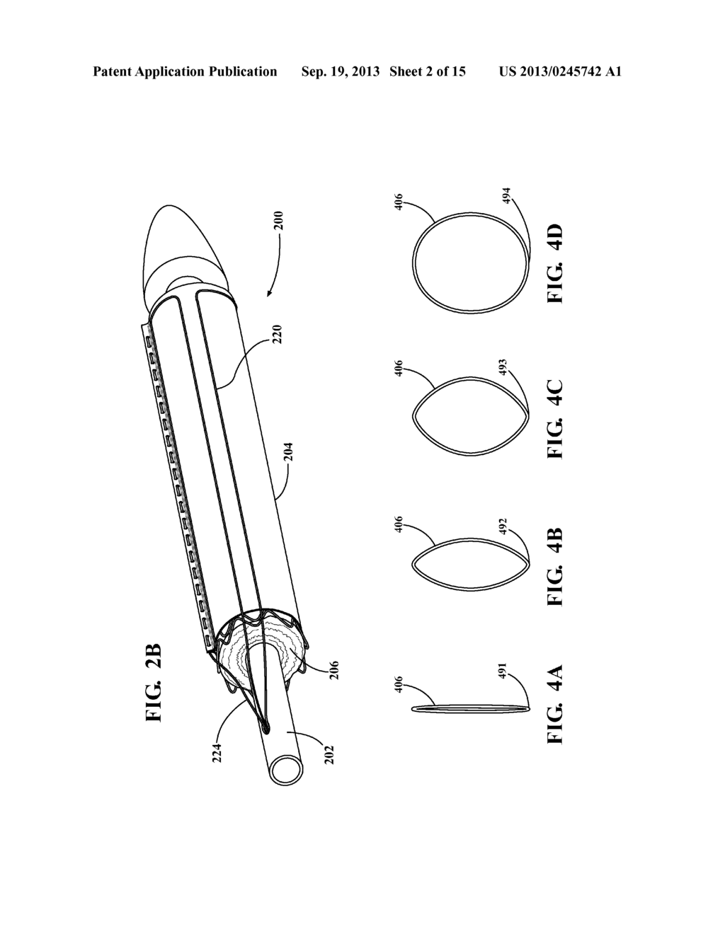 EXTERNAL STEERABLE FIBER FOR USE IN ENDOLUMINAL DEPLOYMENT OF EXPANDABLE     DEVICES - diagram, schematic, and image 03