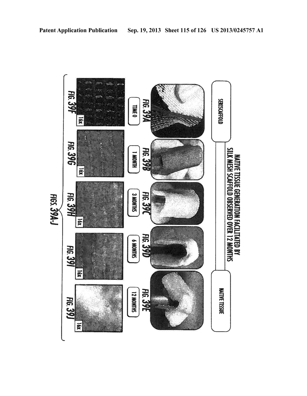 METHOD AND DEVICE FOR IMPROVED SOFT TISSUE SURGERY - diagram, schematic, and image 116