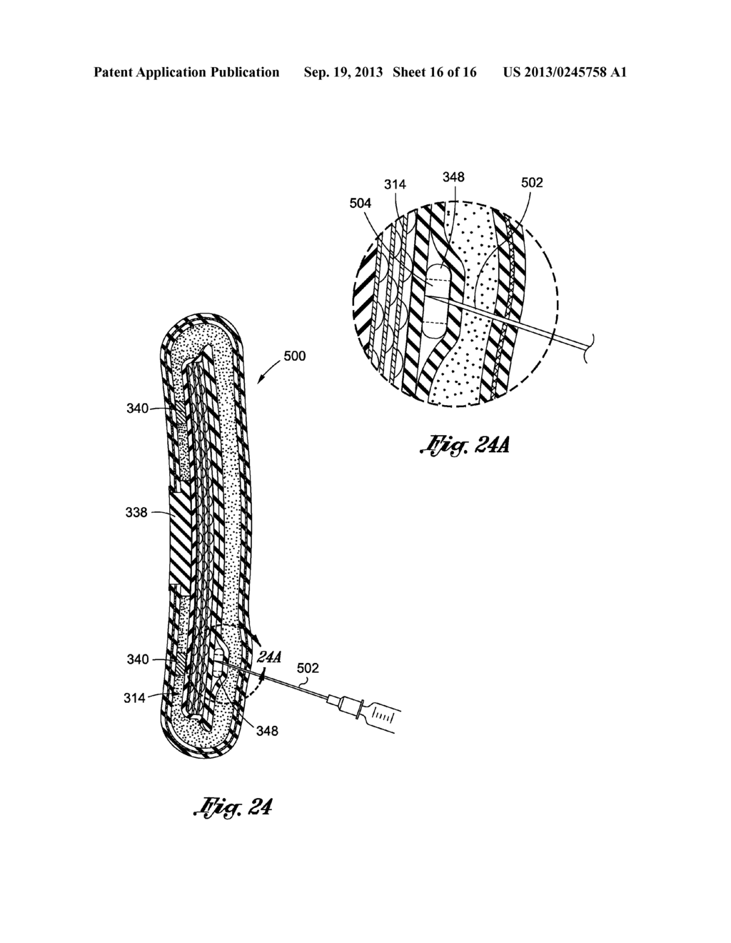 INFLATABLE PROSTHESES AND METHODS OF MAKING SAME - diagram, schematic, and image 17