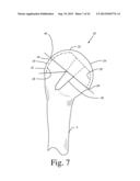 BONE PREPARATION TOOL KIT AND ASSOCIATED METHOD diagram and image