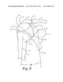 BONE PREPARATION TOOL KIT AND ASSOCIATED METHOD diagram and image