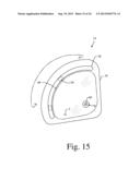 BONE PREPARATION TOOL KIT AND ASSOCIATED METHOD diagram and image