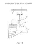 BONE PREPARATION TOOL KIT AND ASSOCIATED METHOD diagram and image