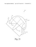 BONE PREPARATION TOOL KIT AND ASSOCIATED METHOD diagram and image