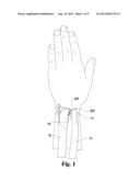 PROSTHESIS FOR DISTAL RADIOULNAR JOINT diagram and image