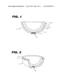 ACETABULAR CUP ASSEMBLY FOR MULTIPLE BEARING MATERIALS diagram and image