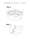 ACETABULAR CUP ASSEMBLY FOR MULTIPLE BEARING MATERIALS diagram and image