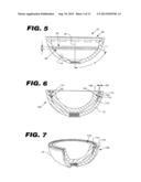 ACETABULAR CUP ASSEMBLY FOR MULTIPLE BEARING MATERIALS diagram and image