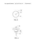 Anchoring Device diagram and image