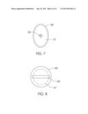 Anchoring Device diagram and image