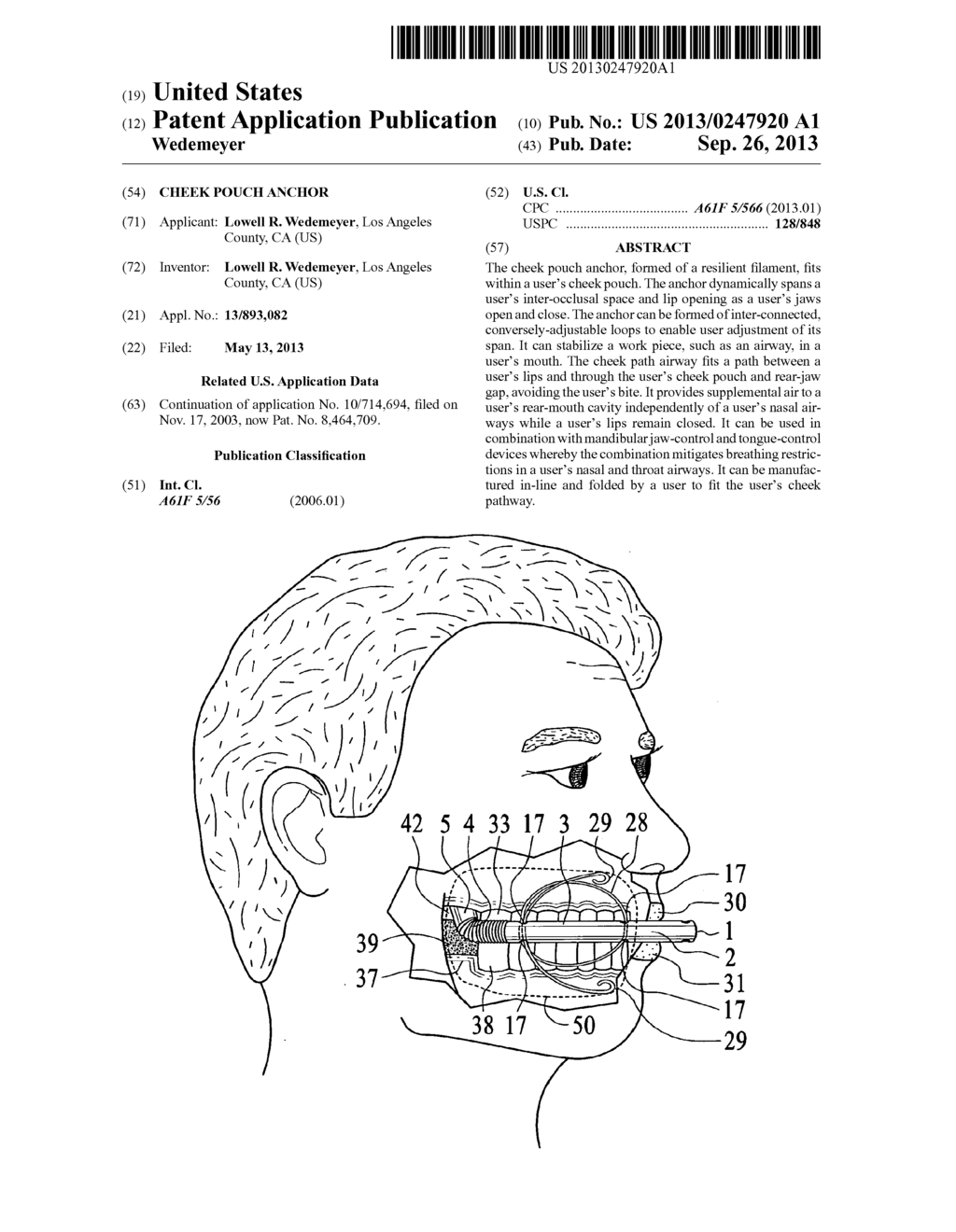 Cheek pouch anchor - diagram, schematic, and image 01