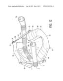 Cheek pouch anchor diagram and image