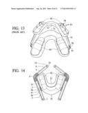 Cheek pouch anchor diagram and image