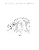 Injection-Molded Composite Construct And Tool For Forming Construct diagram and image