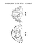 FIDUCIAL SYSTEM TO FACILITATE CO-REGISTRATION AND IMAGE PIXEL CALIBRATION     OF MULTIMODAL DATA diagram and image