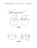 Lens Capsule Size Estimation diagram and image