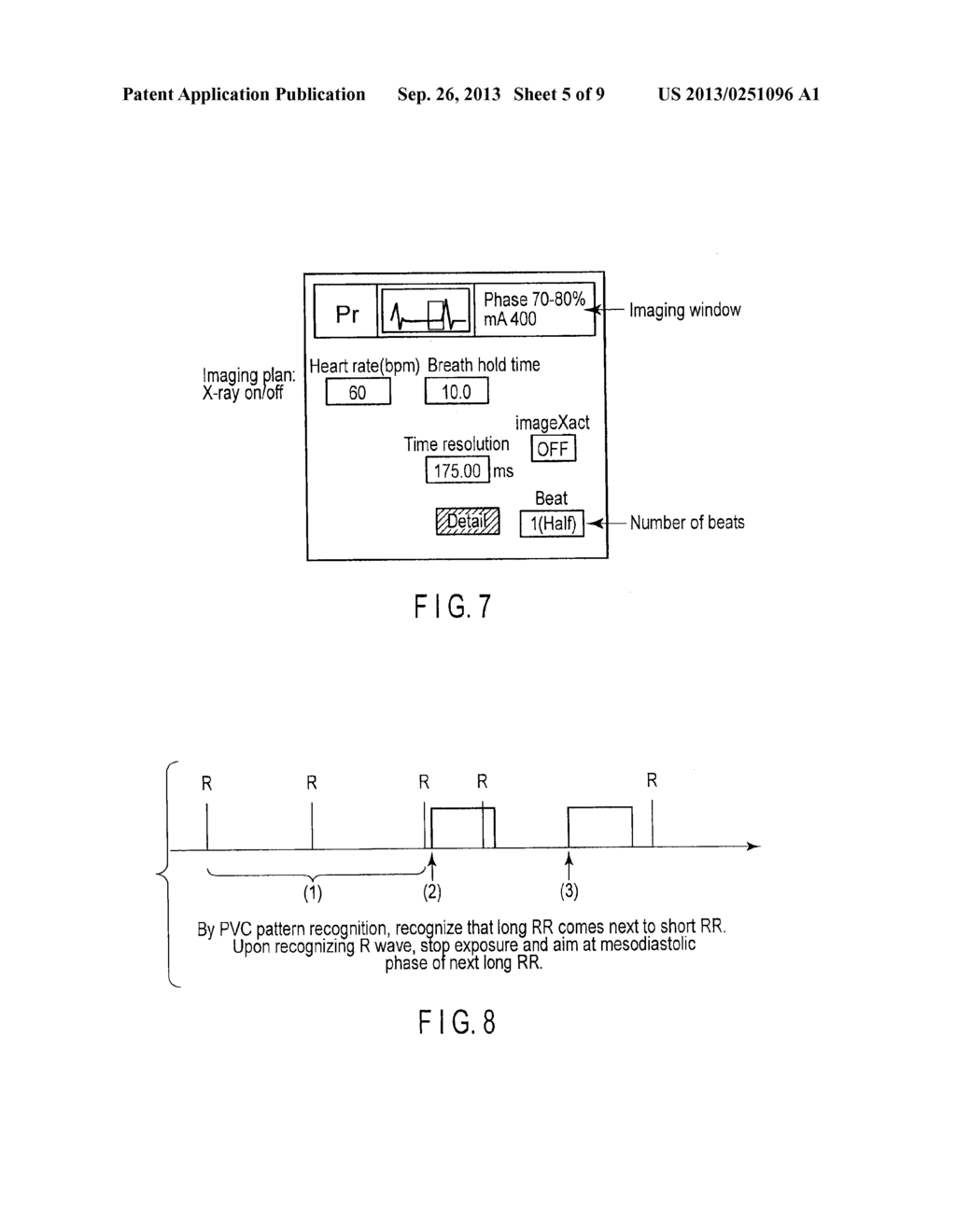 X-RAY COMPUTED TOMOGRAPHY APPARATUS - diagram, schematic, and image 06