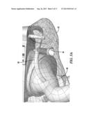 CUSTOM IN-EAR MONITOR diagram and image
