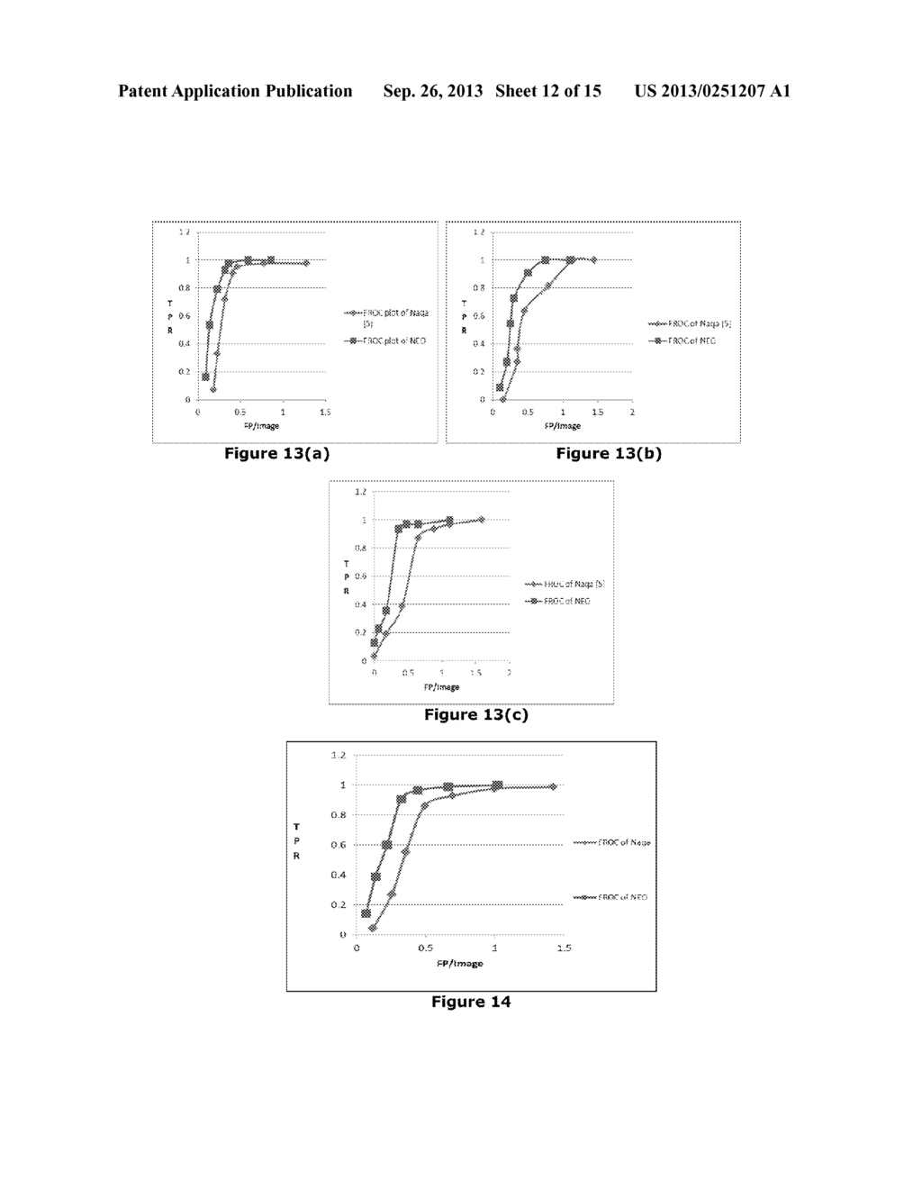 Method and System to Detect the Microcalcifications in X-Ray Images Using     Nonlinear Energy Operator - diagram, schematic, and image 13