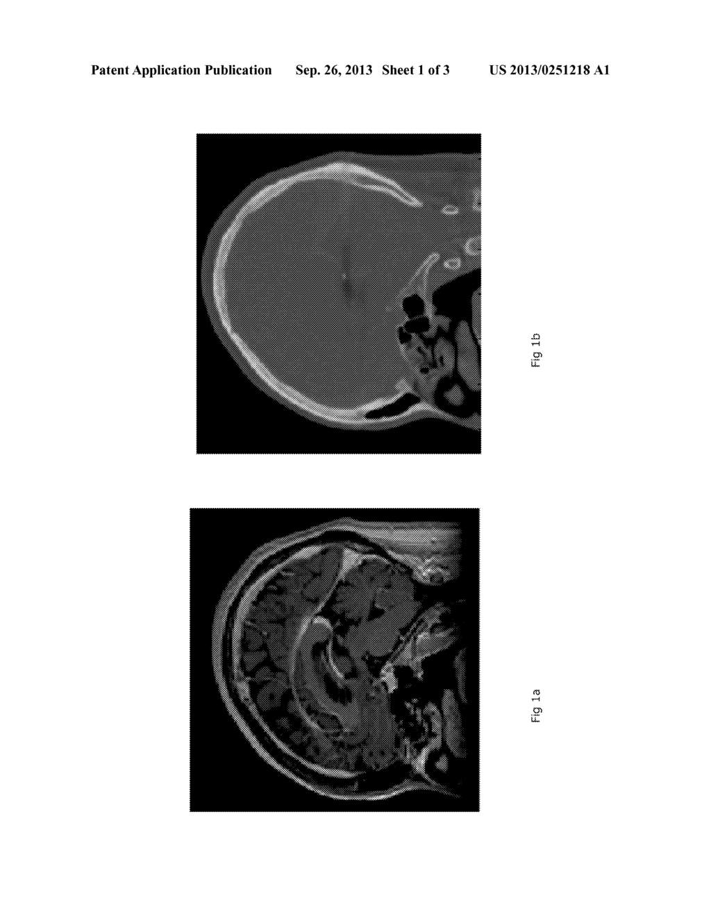 Estimation of Co-Registration Errors - diagram, schematic, and image 02