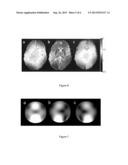 METHODS AND APPARATUS FOR ACCURATE CHARACTERIZATION OF SIGNAL COIL     RECEIVER SENSITIVITY IN MAGNETIC RESONANCE IMAGING (MRI) diagram and image