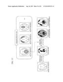 MEDICAL IMAGE PROCESSING DEVICE diagram and image