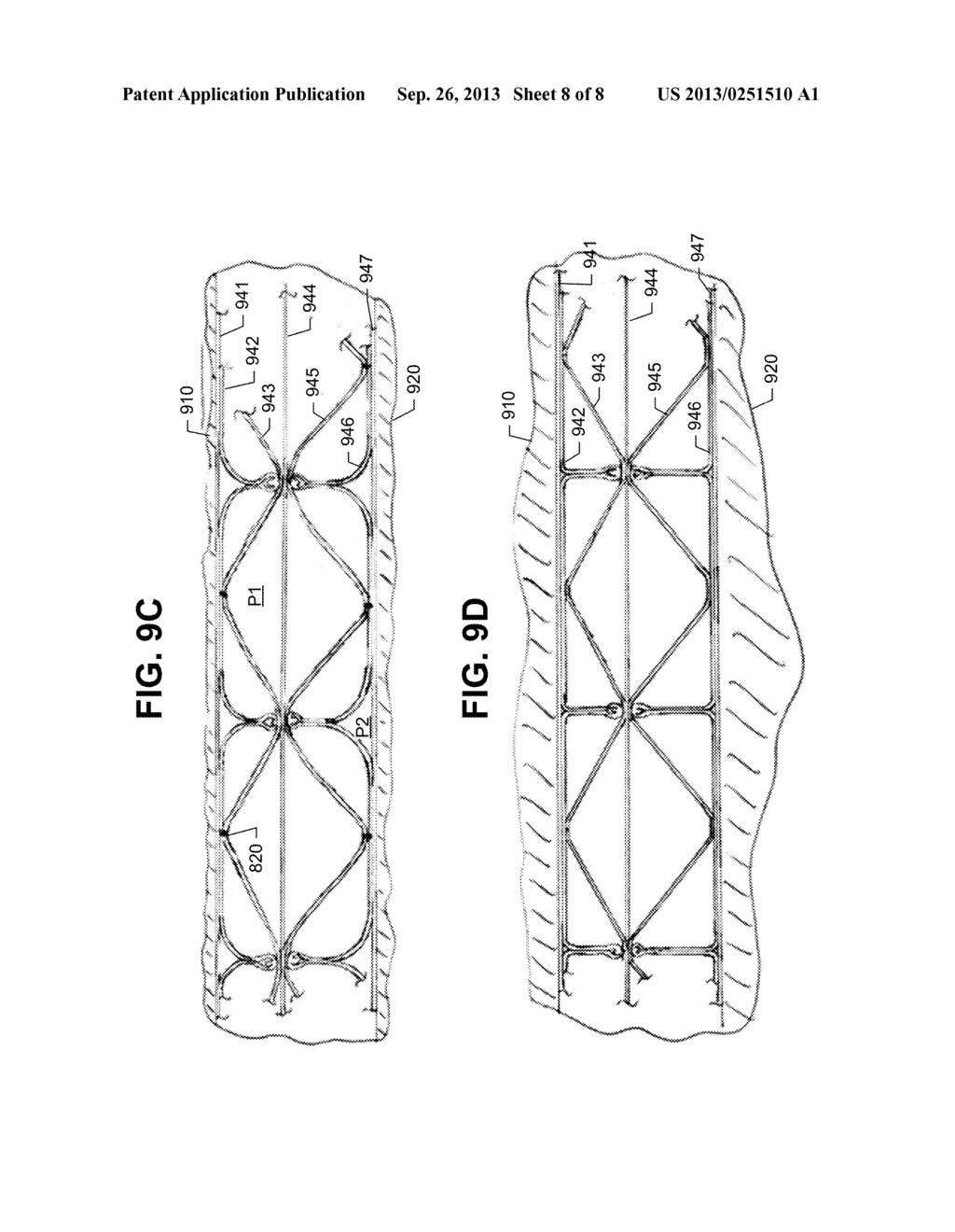 SPF/DB STRUCTURE FOR ATTENUATION OF NOISE FROM AIR FLOW - diagram, schematic, and image 09