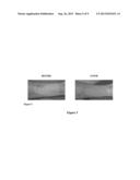 Fetal Skin Cell Protein Compositions For The Treatment Of Skin Conditions,     Disorders Or Diseases And Methods Of Making And Using The Same diagram and image